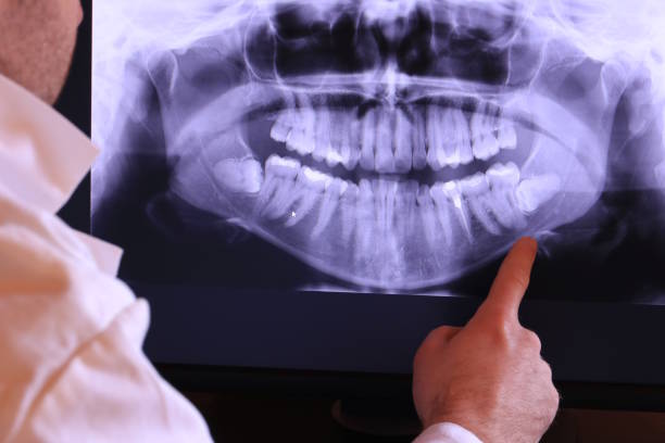 Best Emergency Treatment for Dental Infections or Abscesses in Kershaw, SC